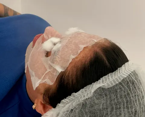 Paciente deitada com máscara facial durante a limpeza de pele
